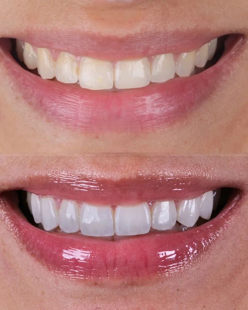 Registro de resultado odontológico 1