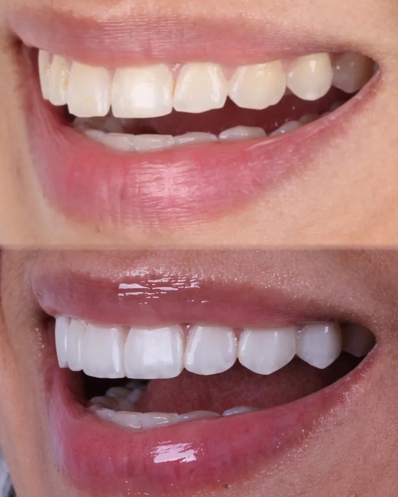 Registro de resultado odontológico 3