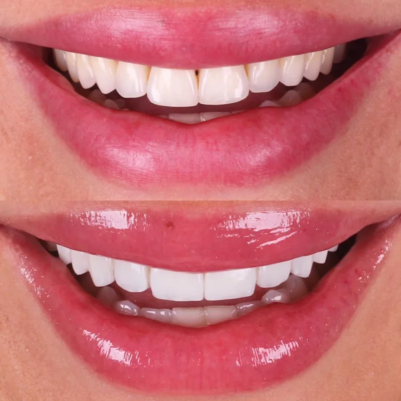 Registro de resultado odontológico 5