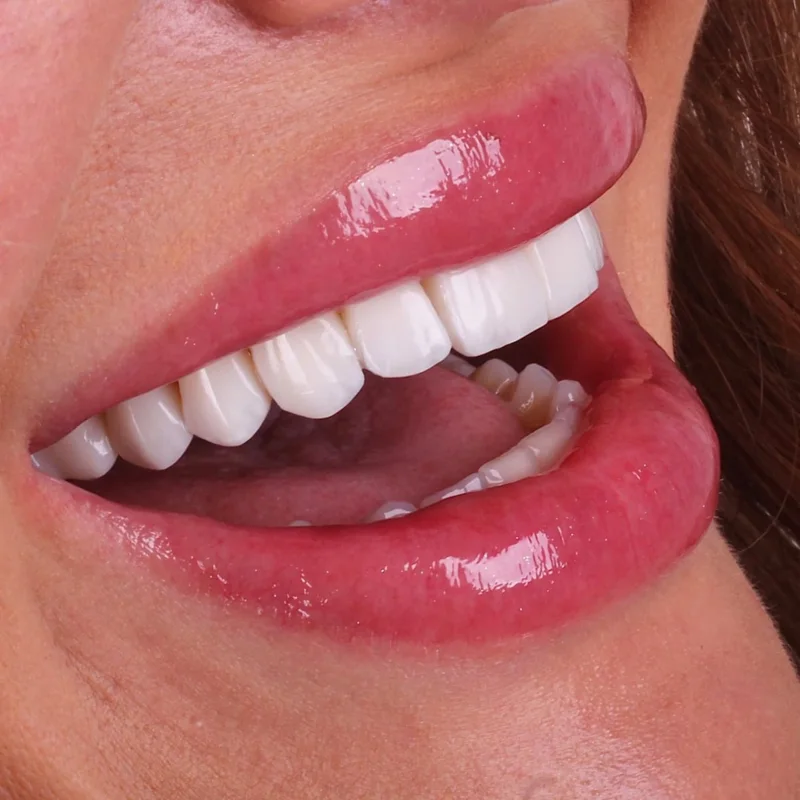 Detalhe de um sorriso