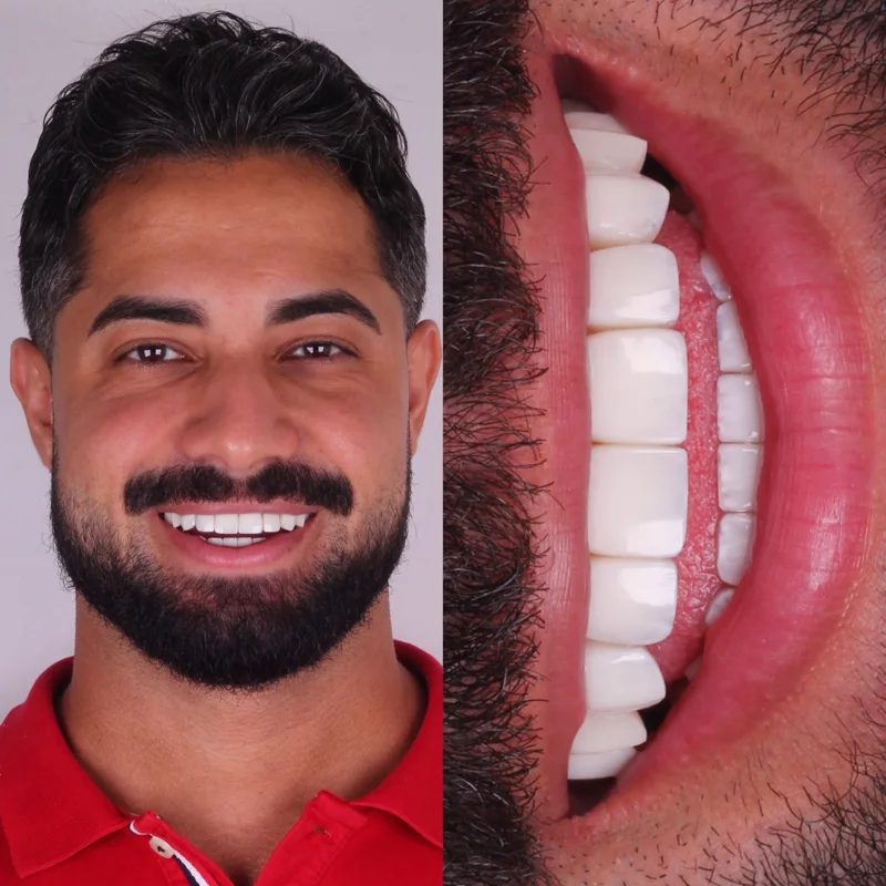 Registro de resultado odontológico 10