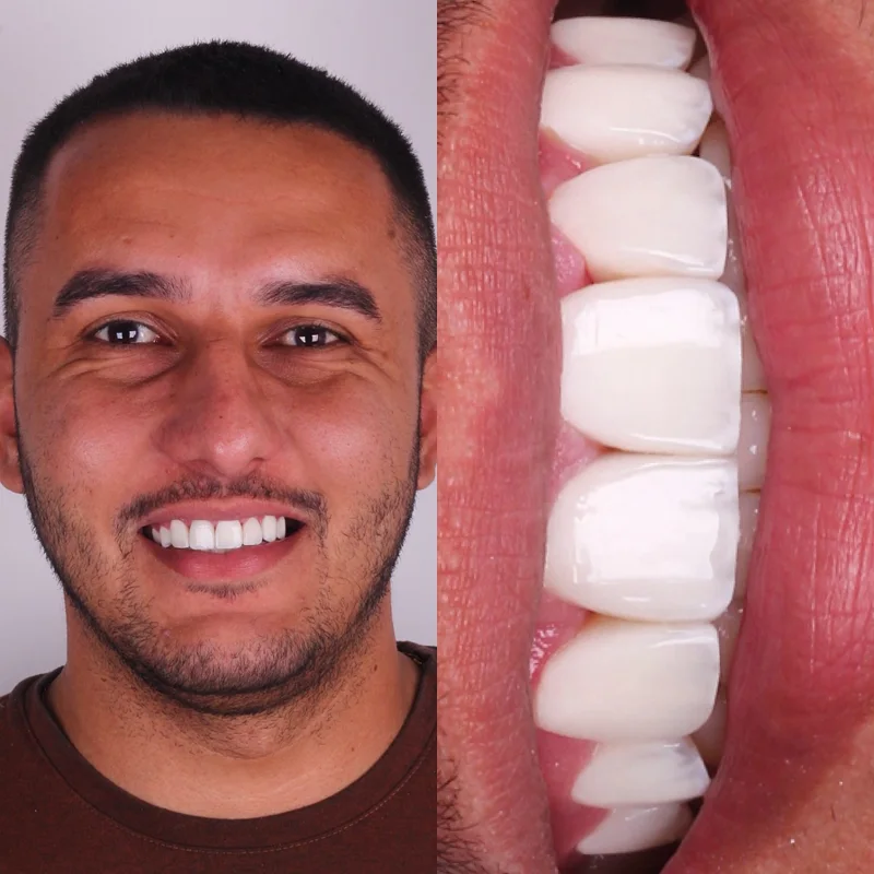 Registro de resultado odontológico 11